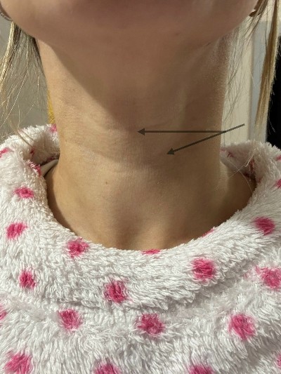 Кольца Венеры: красота или сигнал времени?