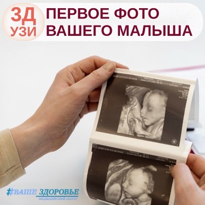 3Д УЗИ по беременности: первое фото вашего малыша — в подарок!