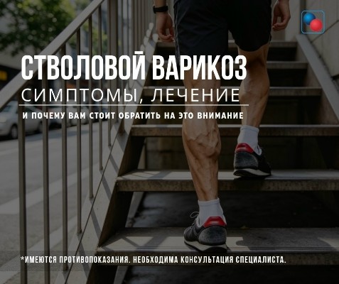 СТВОЛОВОЙ ВАРИКОЗ: симптомы, лечение и почему вам стоит обратить на это внимание.